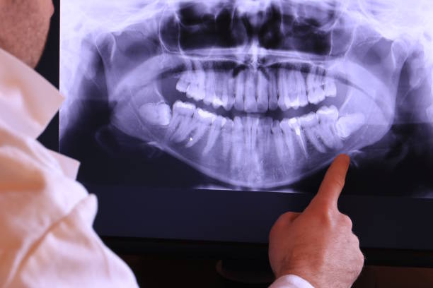 Best Emergency Dentist for Special Needs Patients in Cuthbert, GA