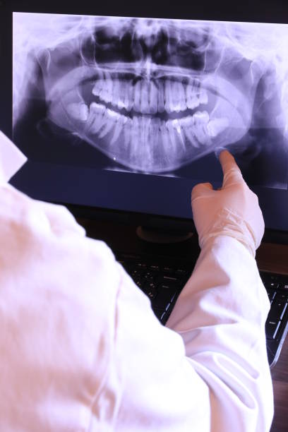 Best Emergency Dentist for Knocked-Out Tooth in Cuthbert, GA