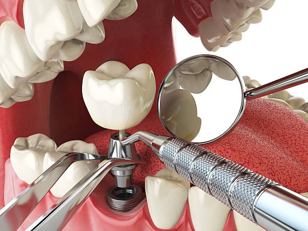 Best Emergency Dental Care for Abscessed Tooth in Cuthbert, GA